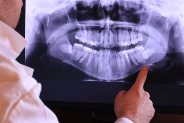 Best Emergency Treatment for Dental Infections or Abscesses in Wailuku, HI